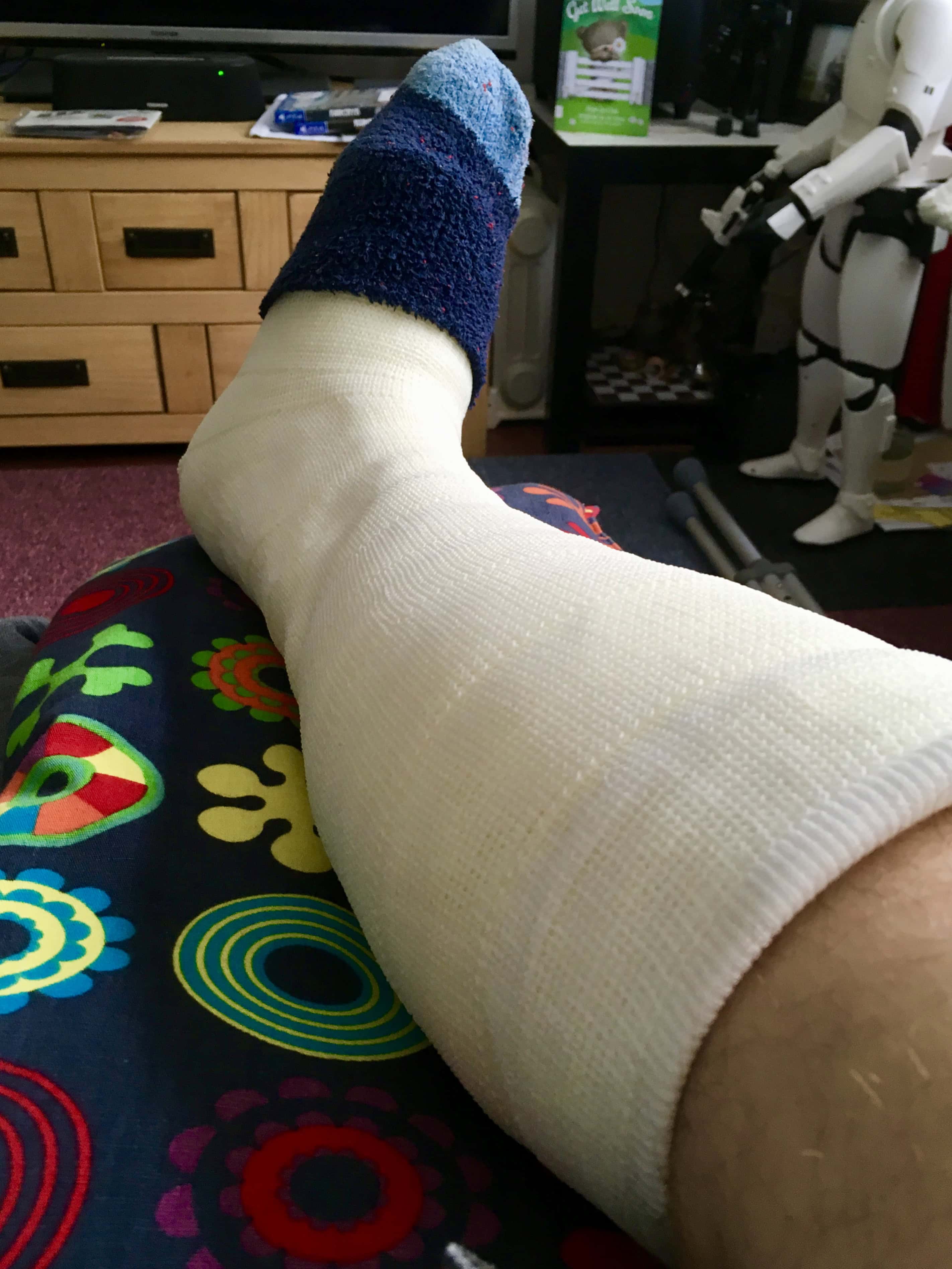 How To Sleep With a Broken Ankle — Bed Tent